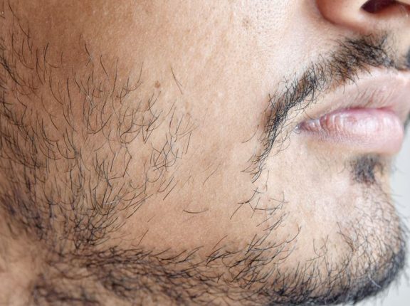 How to Grow a Better Beard