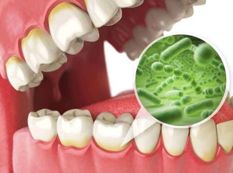 Signs That You Need an Electric Toothbrush